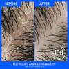 Head Shoulders AntiDandruff Shampoo and Conditioner with 1 Pyrithione Zinc Eucalyptus for Itchy Scalp Care 2in1 Twin Pac