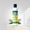 Acne Zap Shampoo for Scalp Acne Clear Scalp from Acne Zits and Pimples 60 oz