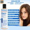 DermaSolve Scalp Psoriasis Dandruff free Medicated Shampoo with Conditioner Ultimate Seborrheic Dermatitis Treatment for