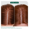 Biolage Scalp Sync Clarifying Shampoo Residue Buildup Remover For Oily Scalp Fermented Tea Glycolic Acid Vegan ParabenFr