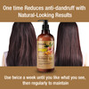 Ultikare Ginger Shampoo for Dandruff Hair AntiDandruff Treatment Itchy Dry Scalp Care Shampoo Ginger Extract Oil Strengt