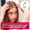 Neutrogena Scalp Therapy AntiDandruff Shampoo for Scalp Buildup Control 25 salicylic acid with Apple Cider Vinegar Fragr