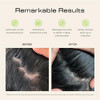 Jupiter Scalp Exfoliator Scalp Massager Tool for Wet Dry Hair Ergonomic Detangler Brush Dandruff Comb Scrub to Remove Da
