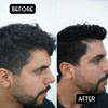 Rolda Black Pomade Medium Hold With Radiant Shine Grey Hair Coverage WaterBased AllDay FlakeFree Formula
