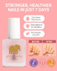ella+mila "First Aid Kiss" Nail Strengthener and Growth treatment- Nail Repair Solution & Growth Treatment for Thin, Brittle & Damaged Nails - Nail H online at globaldelivered