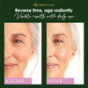 Tree of Life Beauty Retinol Serum Skin Smoothing Face Oil for Dark and Age Spots and Fine Lines Facial Serums for Dry an