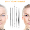 UUBAAR Blackhead Remover Tools 9PCS Pimple Popper Tool Kit Stainless Steel PimpleComedone Extractor Tweezers for AcneZit