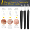 Pimple Popper Tool Kit IUMAKEVP 15 PCS Professional Stainless Steel Blackhead Remover Comedone Extractor Tools for Remov