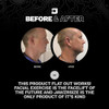 Jawzrsize Pop N Go Jaw Face and Neck Exerciser Define Your Jawline Slim and Tone Your Face Look Younger and Healthier He
