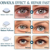Under Eye Patches 60PCS Aloe Vera Collagen Eye Mask Eye Patches for Puffy Eyes AntiAging Eye Mask for Puffiness Under Ey