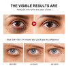 Retinol Eye Stick with CollagenHyaluronic Acid for Dark Circle WrinklesEye Balm Moisturizes Anti AgingVisible Results in