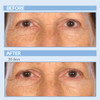 Serious Skincare Retinol A Eye XR Under Eye Cream Concentrate Reduce Fine Lines Dark Circles Puffiness Daily Wrinkle Cre