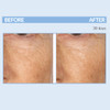 Serious Skincare Retinol A Eye XR Under Eye Cream Concentrate Reduce Fine Lines Dark Circles Puffiness Daily Wrinkle Cre