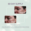 Silc Skin Silicone Eye Pads Reusable Overnight Eye Patches Medical Grade Silicone For Fine Lines And Puffiness Eye Mask