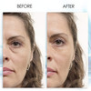 Puffy Eye GEL Instant results Naturally rapid reduction eye gel Eliminate Wrinkles Puffiness and Bags Hydrating Eye Gel
