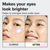 I DEW CARE Hydrogel Eye Patch Starlit Kitten Korean Under Eye Patches for dark circles and puffy eyes Smooths Puffy Eyes