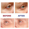 Under Eye Repair Cream AllTransRetinol UNDER EYE REVIVE Anti Aging Eye Cream For Dark Circles And Puffiness Under Eye Ba