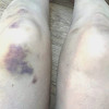 DrMagnesium Cell Repair Cream Bruise Cream Bruise Relief Eye Twitch Facial Swelling Relief High Concentration of Ionized