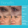 MD Complete Eye Wrinkle Duo Professional Dermatologist Skin Rejuvenation includes Wrinkle Radiance Remedy PLUS with Reti