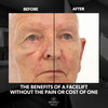 Beverly Hills Mens Instant Facelift and Eye Serum Treatment for Dark Circles Puffy Eyes and Wrinkles
