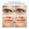 OIA Anti Wrinkle Patches 20 Eyes Smile Smile Lines Eyes Wrinkles Made with 100 Medical Grade Silicon Advanced Wrinkle Ca