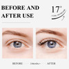Eyelash Growth Serum BREYLEE Lash Boost Serum Eyelash Conditioner for Longer Fuller Thicker Lashes Gold 3ML 01 Fl OzFast