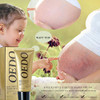 Rose Remove Stretch Marks Cream for Pregnancy Scar Removal Cream Natural Plant Essence Formula Prevention Remove Stretch