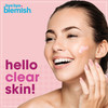 Bye Bye Blemish Acne Drying Lotion Reduce Pimples Overnight 1oz 1Pack