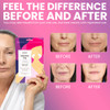 MISS SPA Smile Line Patches Reusable 20 Times Hydrating and Smoothing Smile Lines Silicone Patches for Frown Lines AntiA