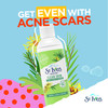 StIves Solutions 3in1 Face Toner For Combination to Oily and Acne Prone Skin Clear Skin Made with 100 percent Natural Te