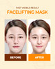 CRAZY SKIN Perfect Faical Mask 5PCS Wash Off Mask Pack Lifting VLine Slim Face Mask 2 Step Care for Aging Skin Face Mask