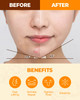 CRAZY SKIN Perfect Faical Mask 5PCS Wash Off Mask Pack Lifting VLine Slim Face Mask 2 Step Care for Aging Skin Face Mask