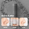 Charcoal Blackhead Remover Stick Blackhead Extractor