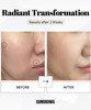 Sumukhwa Miracle Snail Mucin 97 Korean Skincare Large Size 150ml Snail Mucin Serum with Snail Secretion Filtrate 97 and