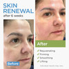 Collagen Face Cream with Stem Cells Retinol Hyaluronic Acid Niacinamide for All Skin Types AntiAging Face Moisturizer wi