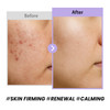 coxir Black Snail Collagen Cream Snail Mucin Peptide Face Moisturizer for Hydration Elasticity Barrier Support Lightweig