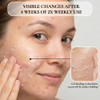 Vivo Per Lei Facial Peeling Gel Helps Address Dead Skin Buildup Gentle Exfoliating Gel for Rough Dry Sensitive or Mature