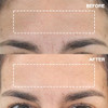 Wrinkles Schminkles Forehead Wrinkle Patches Reusable Silicone Smoothing Pads for Brow Lift Wrinkle Smoothers Reduce Fro
