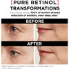 LOreal Paris Revitalift Triple Power LZR Retinol Night Serum For Face With 03 Pure Retinol Moisturizes Skin and Eliminat