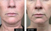 Kleem Pure Vitamin C Serum for Face for Women with Hyaluronic Acid Vitamin E Anti Aging Serum to Boost Collagen Reduce W