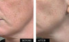 Kleem Pure Vitamin C Serum for Face for Women with Hyaluronic Acid Vitamin E Anti Aging Serum to Boost Collagen Reduce W