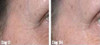 Golden Serum for Skin Tightening Firming and Sagging Prevention Dmae APT Marine Algae Pepha Tight Hyaluronic Acid Vitami