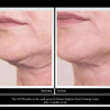 Kleem Neck Firming Cream Retinol Moisturizer for Face Dcollet Anti Aging Cream for Women Smooth Fine Lines Wrinkles Crep