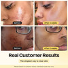 Gleamin Vitamin C Clay Mask for Dark Spots Turmeric Clay Face Mask Skin Care Deeply Cleanses Refines Pores Brightens Une