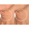 SiO Beauty FaceLift Reusable AntiWrinkle Patches for Neck Forehead Eye Smile Overnight Smoothing Silicone for Fine Lines