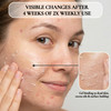 Vivo Per Lei Facial Peeling Gel Helps Address Dead Skin Buildup Gentle Exfoliating Gel for Rough Dry Sensitive or Mature