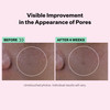 StriVectin MultiAction Super Shrink Pore Minimizing Serum for minimizing clogged pores and blackheads for tightening and