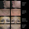 Adonia Organics StemuLift AntiAging Face Moisturizer Vegan Daily Wrinkle Cream with Plant Stem Cells Hydrates Firms Smoo