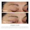 Epionce Intense Defense Serum AntiAging Facial Serum with Vitamin C Vitamin E Vitamin D A B Niacinamide Dermatologist Sk