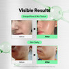 VT COSMETICS CICA Reedle Shot 700 Spicule Microneedling Serum for Pore CareExfoliation ExosomeCentella Asiatica for Glas